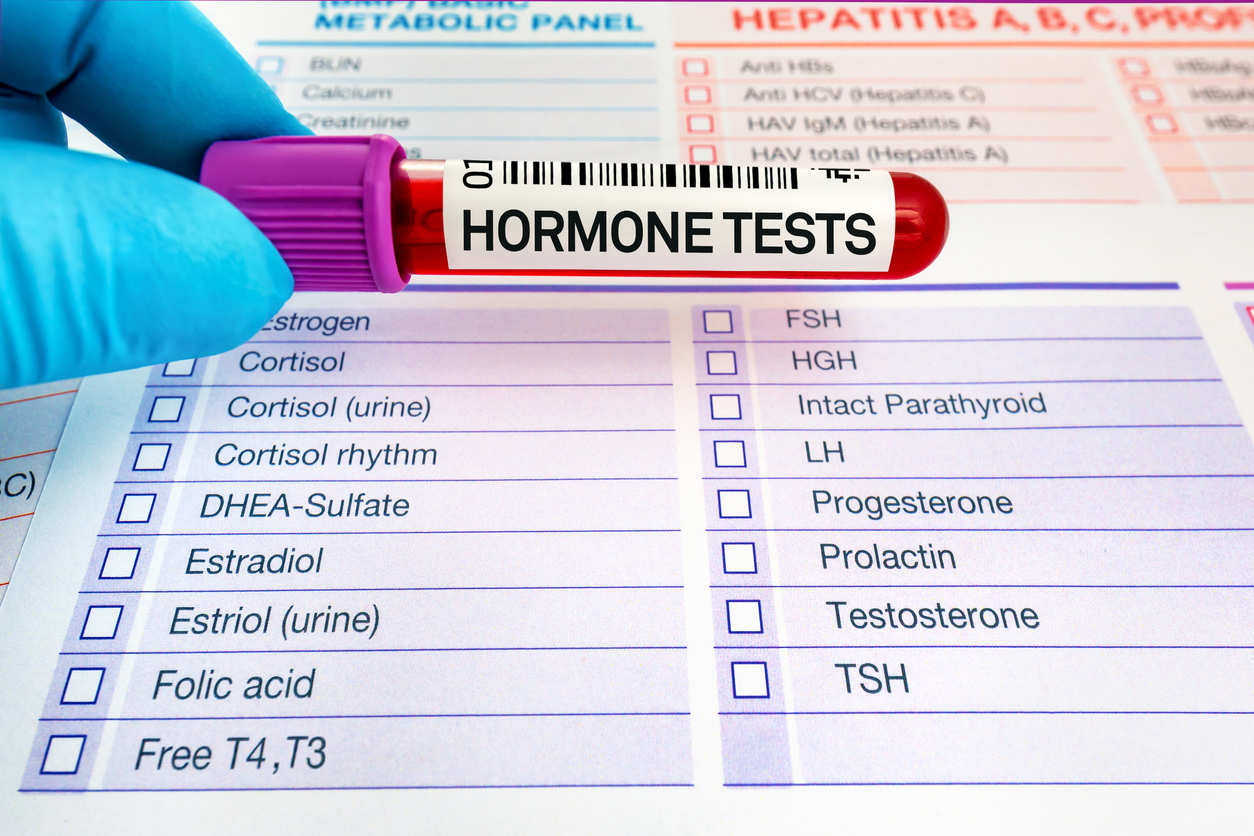 Do You Need Your Hormones Tested?